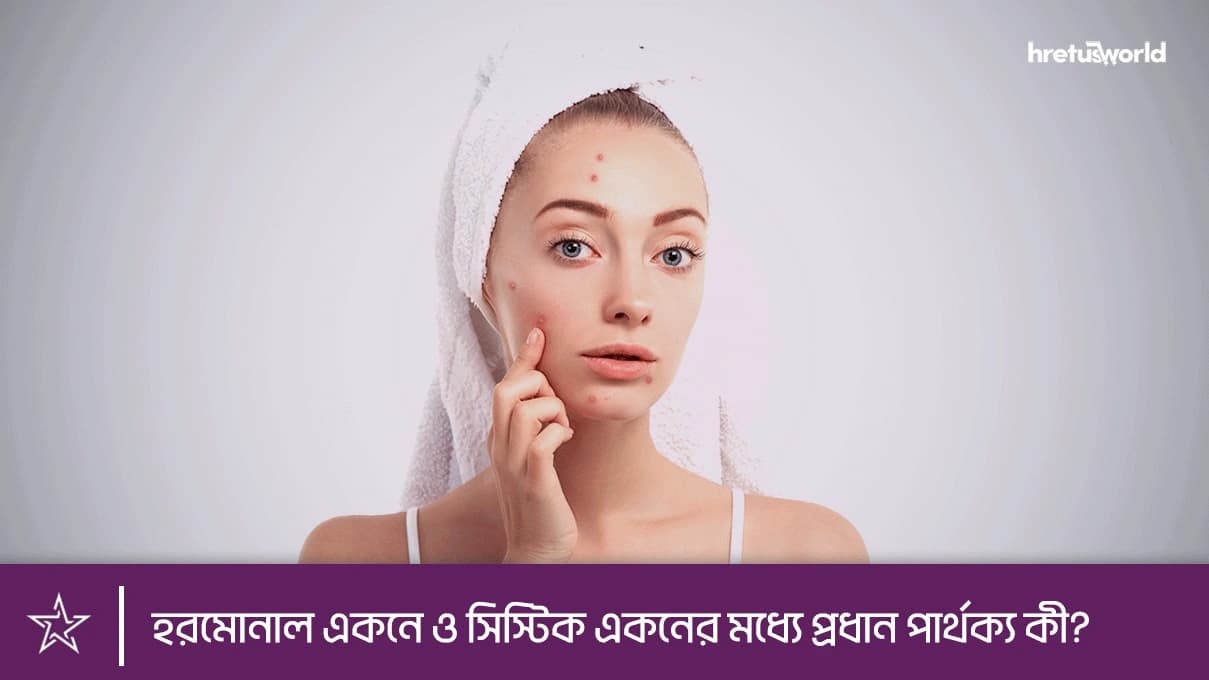 হরমোনাল একনে ও সিস্টিক একনের মধ্যে প্রধান পার্থক্য কী?
