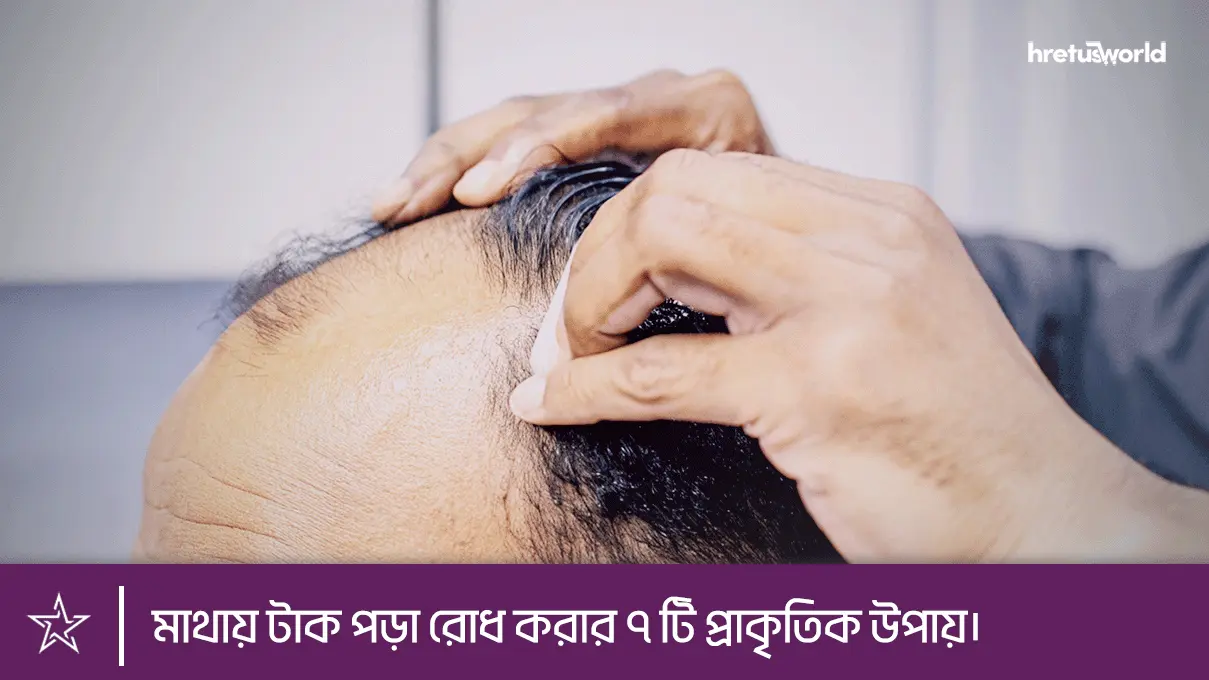 মাথায় টাক পড়া রোধ করার ৭ টি প্রাকৃতিক উপায়।