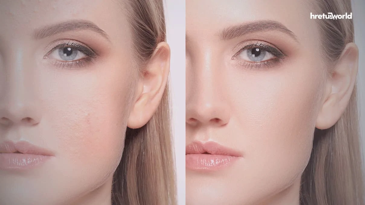 ত্বকের যত্নে রেটিনল ব্যবহার ও এর কাজ। 2 dead skin remove deference
