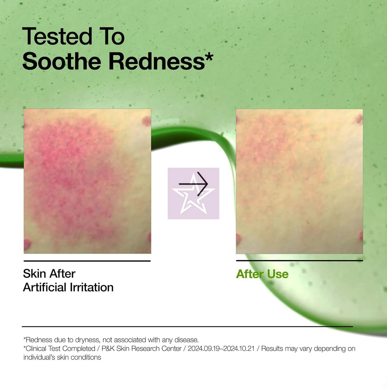 Anua Azelaic Acid 10